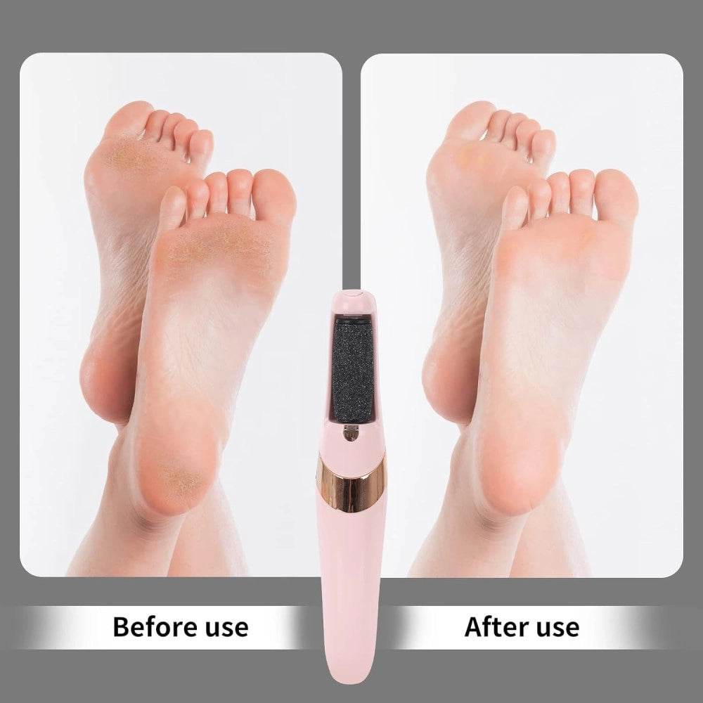 Trade Shop - Pedicure A Batteria Ricaricabile Elimina Calli Rimuovi Duroni Piedi Esfoliante -