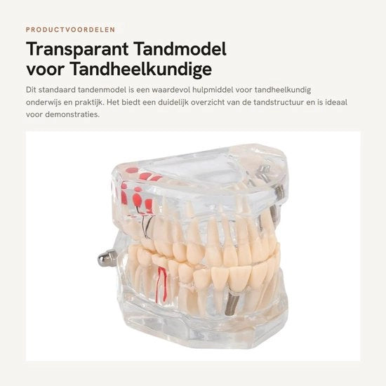 Modello di Tutto il Dente Adulto - Transparente Modello di Dimostrazione - Modello Odontoiatrico - Modello Orale Patologico - 9x7x7cm - Plastica 232g